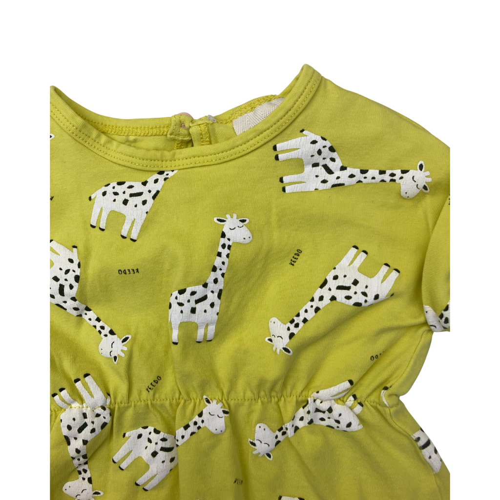 0-3M Yellow & White Giraffe Easy Waist Top - Keedo